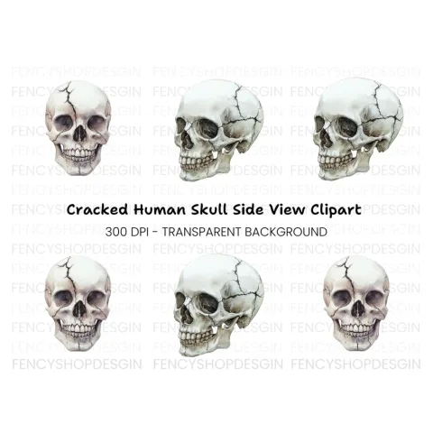 Cracked Skull Side View Clipart Bundle